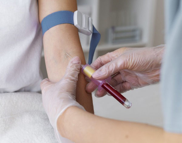 Lab Test Home Collection Dubai