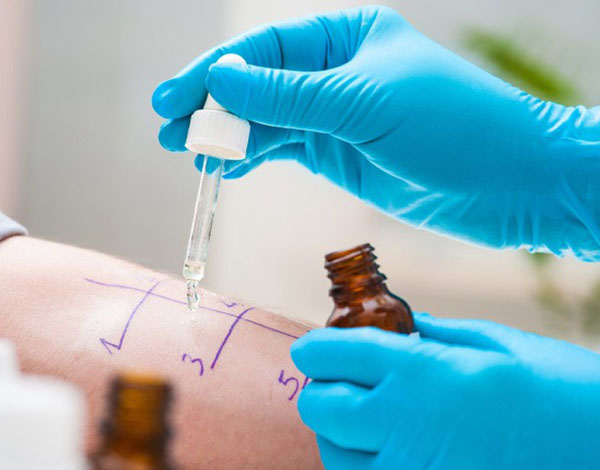 allergy test UAE
