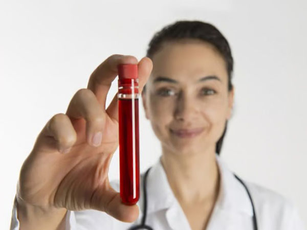 cancer marker test UAE