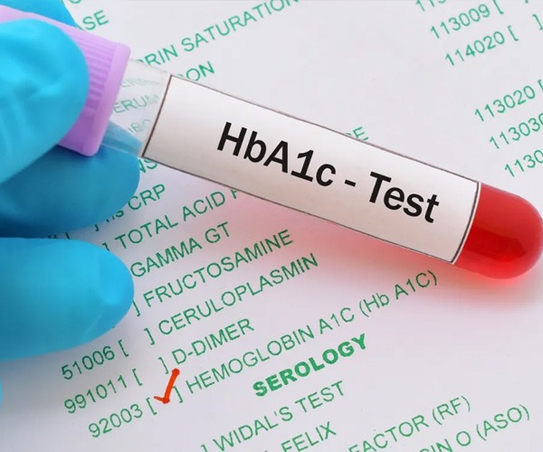 HbA1c test Dubai