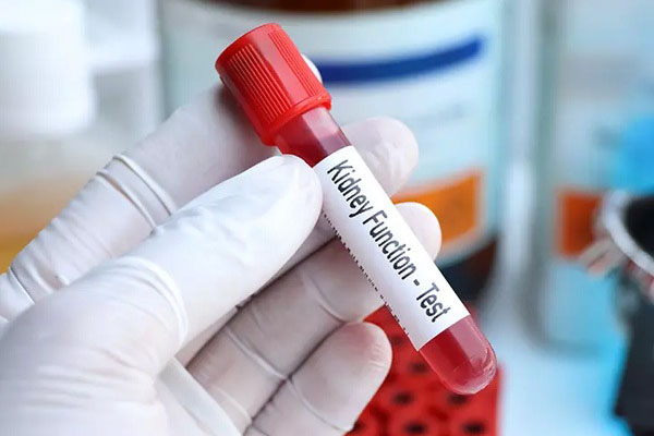  liver function test Dubai